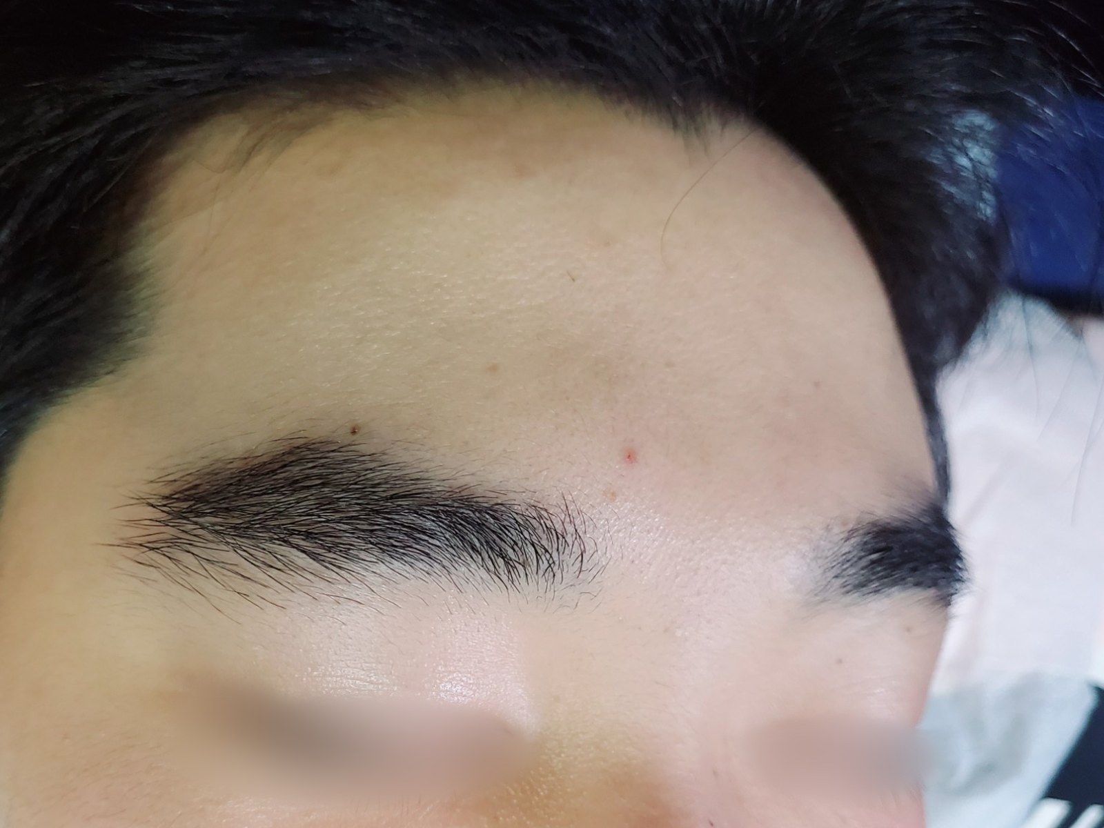 시술 전 — 눈썹 왁싱