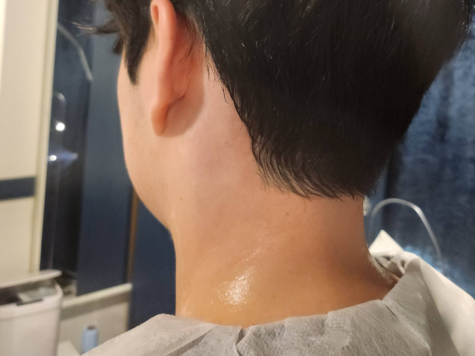 시술 후 — 뒷목 왁싱